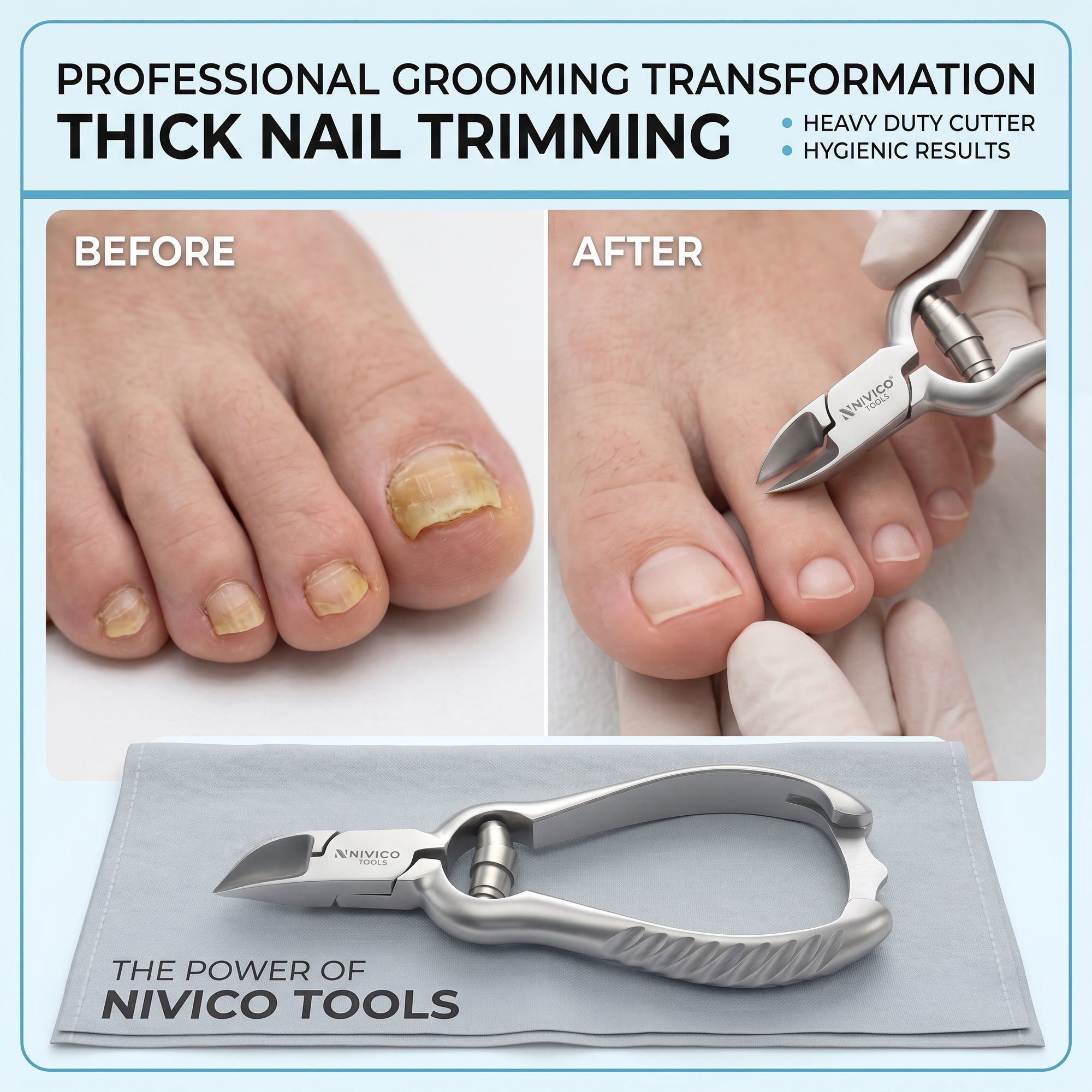 Professional Toenail Cutter – Heavy Duty Podiatry Clippers for Thick & Hard Nails
